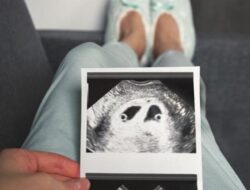 Sempat Dilakukan Luna Maya di 2021, Apa itu Egg Freezing?